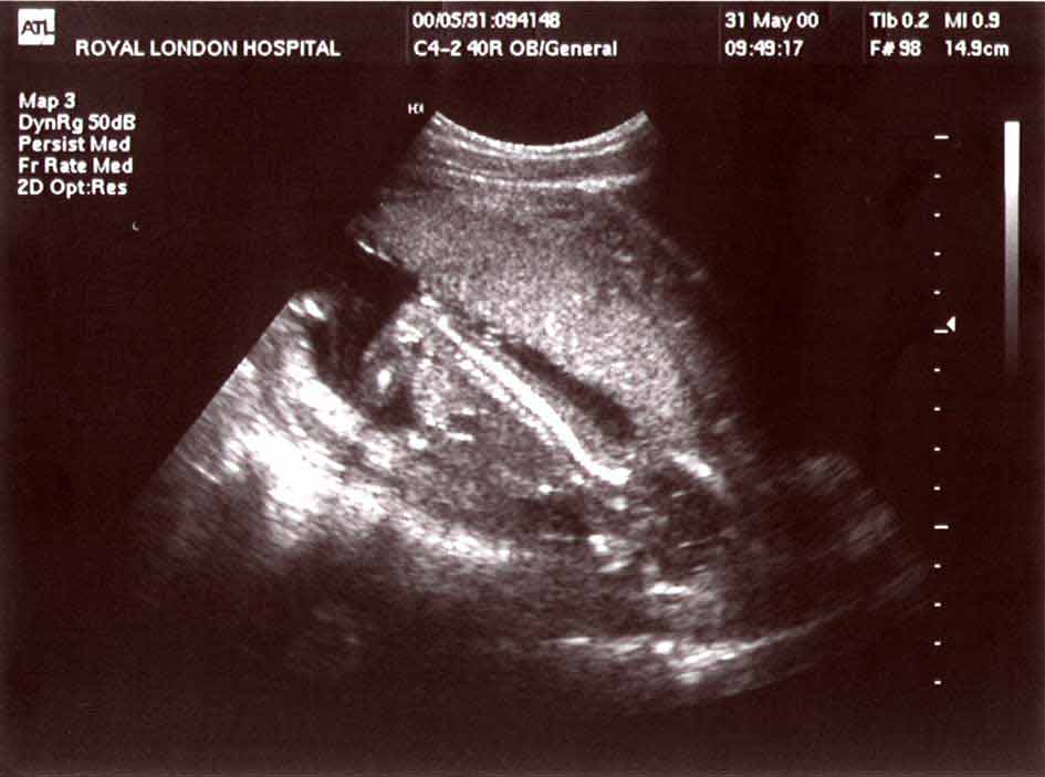 theos-baby-for-web.jpg (40189 bytes)